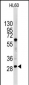 LIN28B Antibody (N-term)